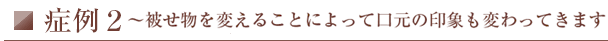 症例２～被せ物を変えることによって口元の印象も変わってきます